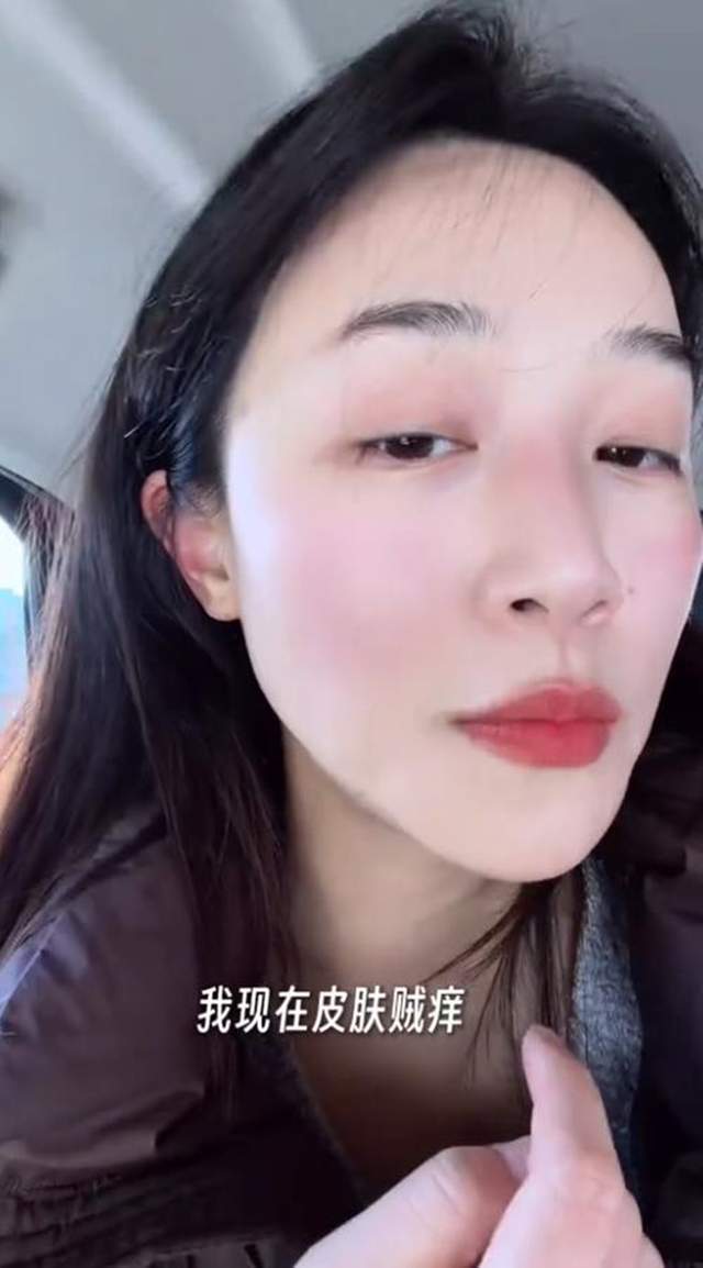 原創藍盈瑩吉林遊玩，零下24度戶外只待半個小時就被凍傷，臉又紅又腫