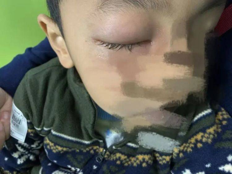 深圳一男童出國旅遊，突發罕見病！一家緊急回國