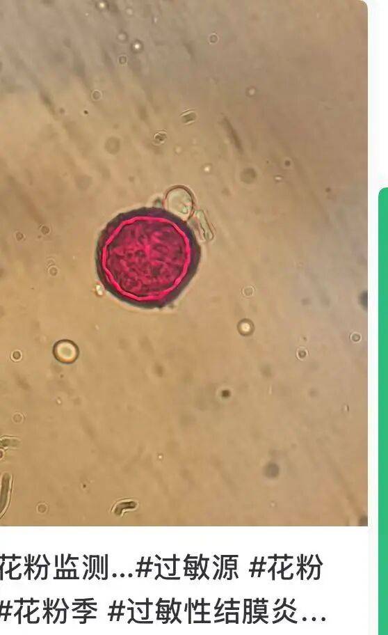 戴口罩！關閉門窗！今年提前“殺到”，多人中招！深圳網友：臉都腫了